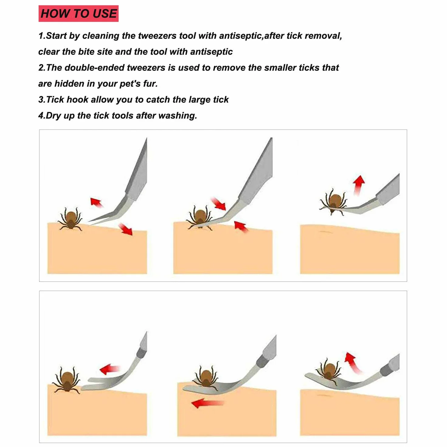 YOUYIKE® Pinzas para garrapatas,Acero Inoxidable Pet Perros Gatos garrapatas Remover Kit,3 Premium tickremover + Caja de Almacenamiento