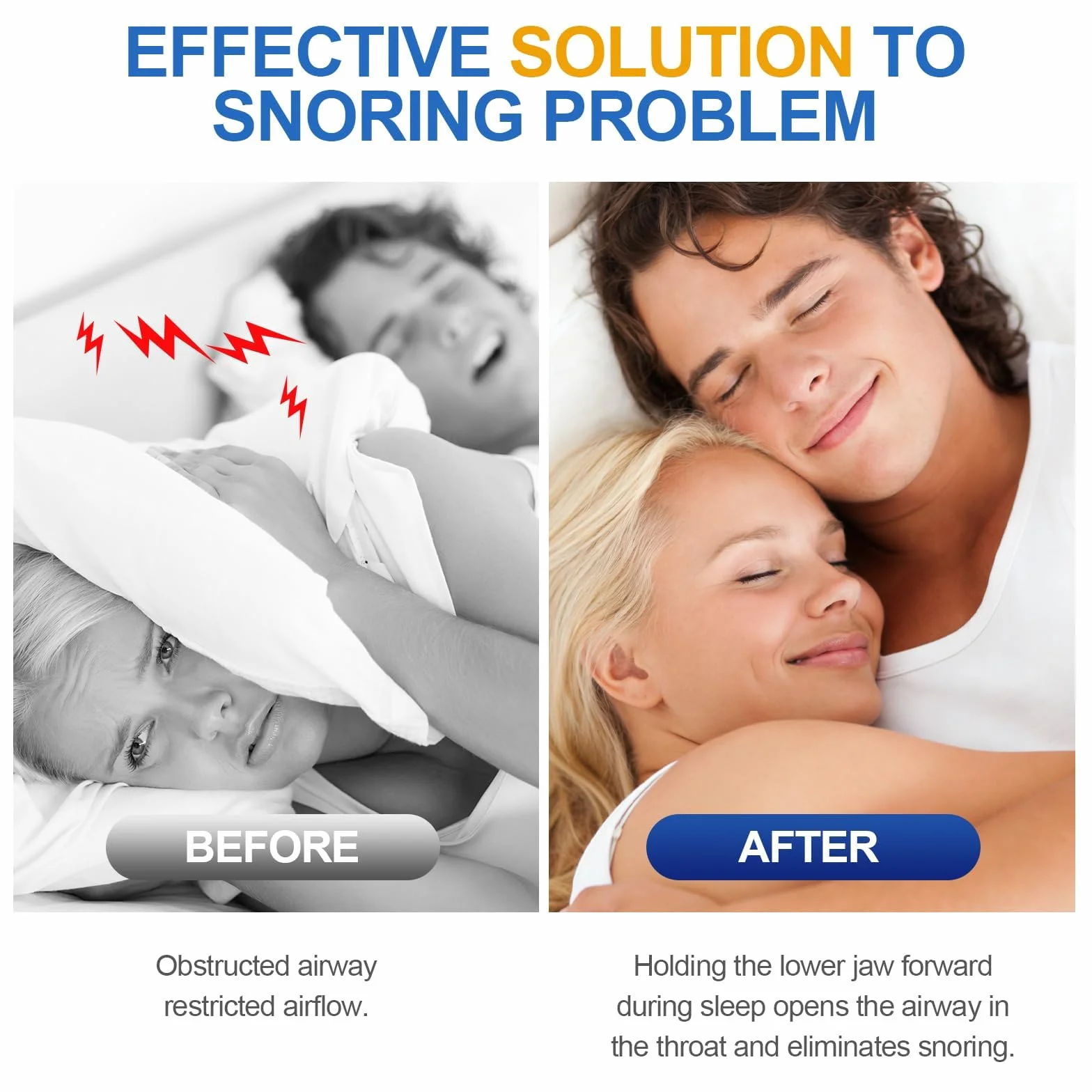 Férula Dental Antironquidos para Dormir Reutilizable para Hombres y Mujeres